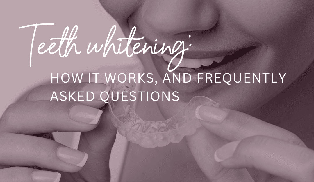 Teeth whitening how it works blog