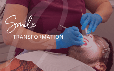 Smile transformation at Oakwood Dental Practice